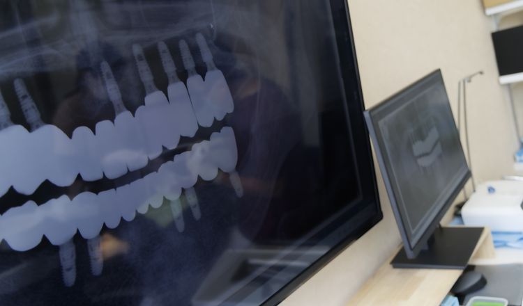 精密検査の画像を確認する様子